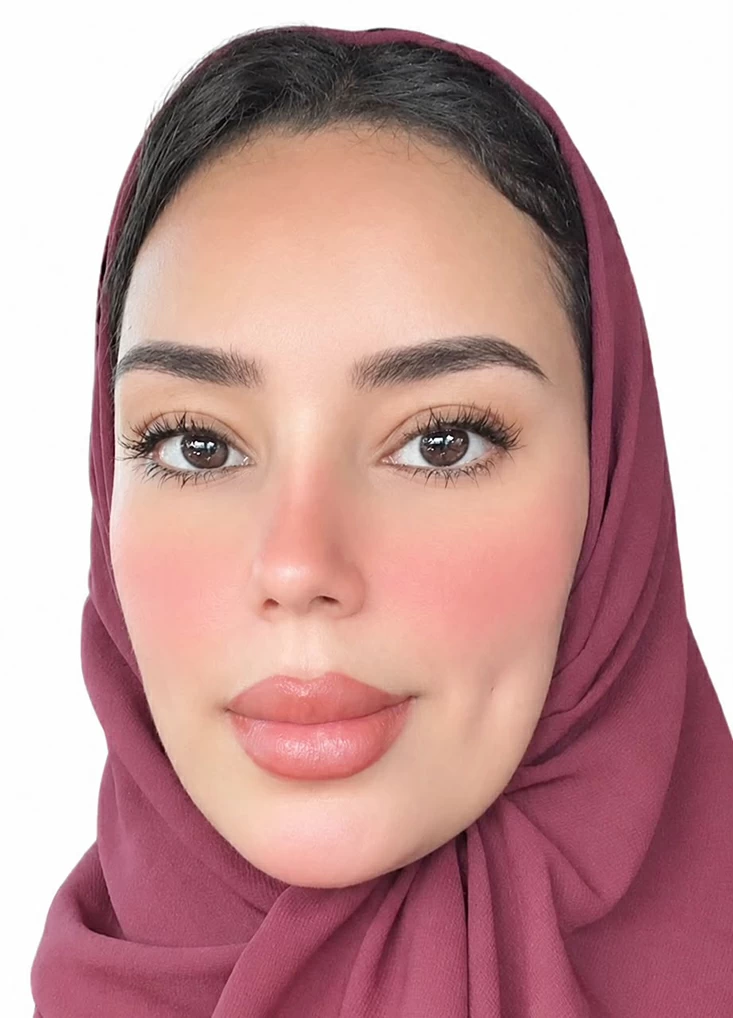 الاعتداءات الحوثية على الأعيان المدنية جريمة حرب الاعتداءات الحوثية على الأعيان المدنية جريمة حرب